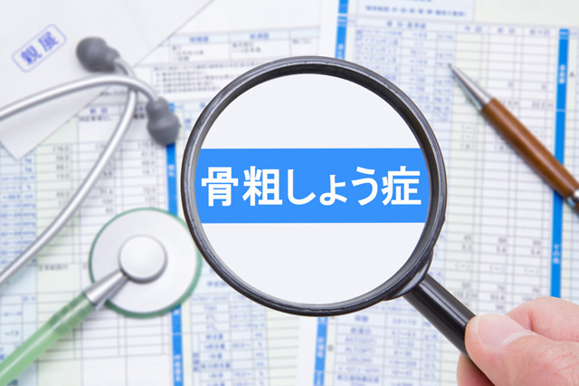 「骨粗鬆症」の予防法や「なりやすい人の特徴」を医師が解説 骨が脆い人におすすめの食べ物とは?