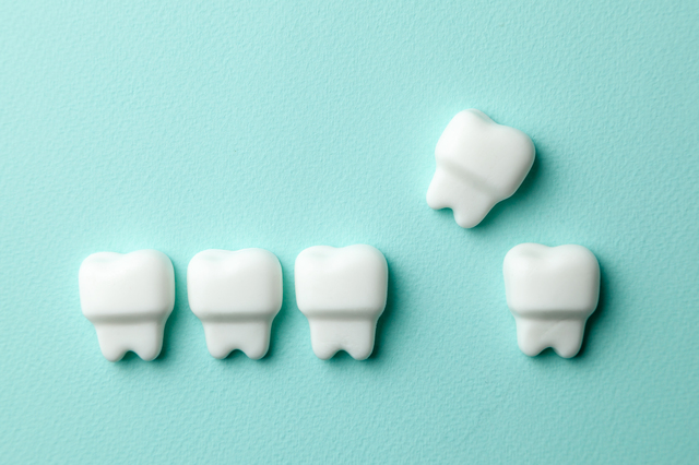 「よく噛むこと」はメリットがいっぱい!手軽に実践できる5つのコツ